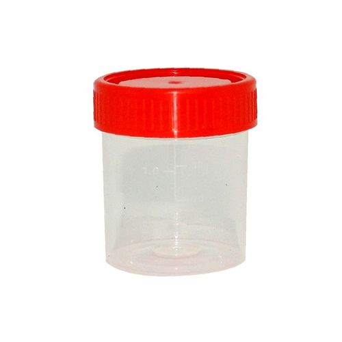 Шээсний шинжилгээний сав 60мл